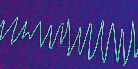 Foto de ECG que muestra el ritmo de Torsades de pointes, ritmo cardíaco peligroso con latidos rápidos e irregulares girando alrededor del eje eléctrico, causando potencialmente desmayos o paro cardíaco, ilustración 3D - Imagen libre de derechos
