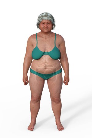 Téléchargez les photos : Illustration 3D d'un corps féminin de type endomorphe, caractérisé par un pourcentage plus élevé de graisse corporelle et une forme plus arrondie. - en image libre de droit