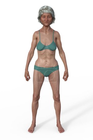 Photo for A 3D illustration of a female body with ectomorph body type, characterized by a lean and slender build with minimal body fat. - Royalty Free Image