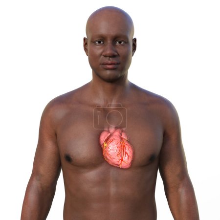 Photo for A 3D photorealistic illustration of the upper half part of an African man with transparent skin, revealing detailed anatomy of the heart - Royalty Free Image
