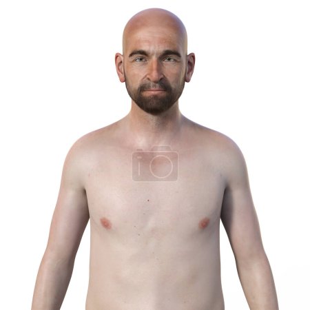 Foto de Una ilustración fotorrealista en 3D que muestra la mitad superior de un hombre con barba, desprovisto de pelo, mirando con confianza a la cámara, revelando su piel, rasgos faciales y anatomía corporal - Imagen libre de derechos