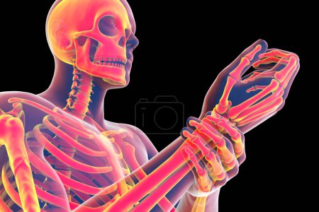 Foto de Un hombre que experimenta dolor en la muñeca, con el esqueleto resaltado para mostrar el área afectada, ilustración 3D - Imagen libre de derechos
