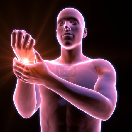 Foto de Un hombre que experimenta dolor de muñeca, ilustración conceptual 3D - Imagen libre de derechos