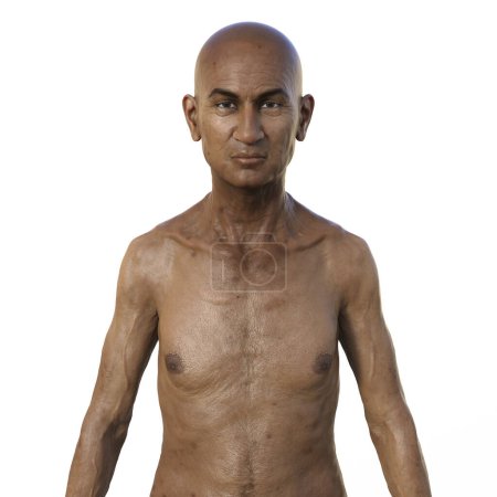 Téléchargez les photos : Illustration photoréaliste en 3D représentant la moitié supérieure d'un Indien âgé, chauve et nu, mettant en valeur sa peau vieillissante et les changements anatomiques qui viennent avec l'âge - en image libre de droit