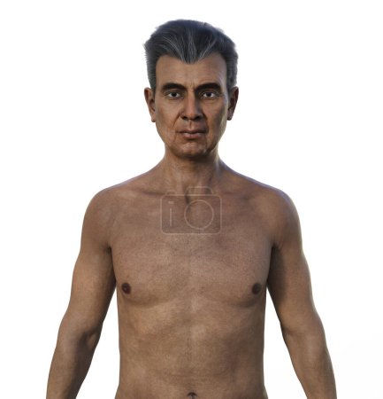 Foto de Una ilustración fotorrealista en 3D que presenta la mitad superior de un hombre indio anciano, mostrando su piel envejecida y los cambios anatómicos que vienen con la edad. - Imagen libre de derechos