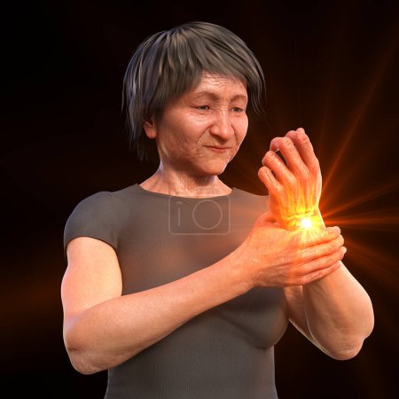 Photo for A woman experiencing wrist pain, with the skeleton highlighted to show the affected area, 3D illustration - Royalty Free Image