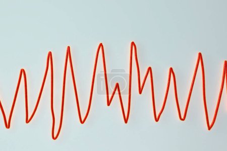 Photo for ECG displaying Torsades de pointes rhythm, dangerous heart rhythm with fast, irregular beats twisting around the electrical axis, potentially causing fainting or cardiac arrest, 3D illustration - Royalty Free Image