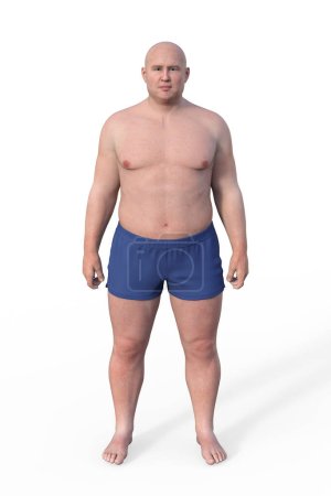 Photo for A 3D illustration of a male body with an endomorph body type, characterized by a higher percentage of body fat and a rounder shape. - Royalty Free Image