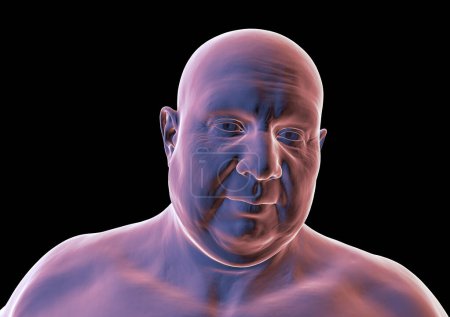 Téléchargez les photos : Portrait d'un homme présentant une composition corporelle en surpoids, illustration médicale 3D soulignant les implications physiologiques de l'excès de poids - en image libre de droit
