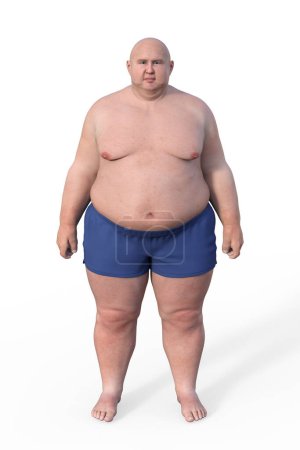 Téléchargez les photos : Illustration médicale 3D complète représentant une représentation corporelle complète d'un homme présentant une composition corporelle en surpoids, mettant en évidence les implications physiologiques de l'excès de poids. - en image libre de droit