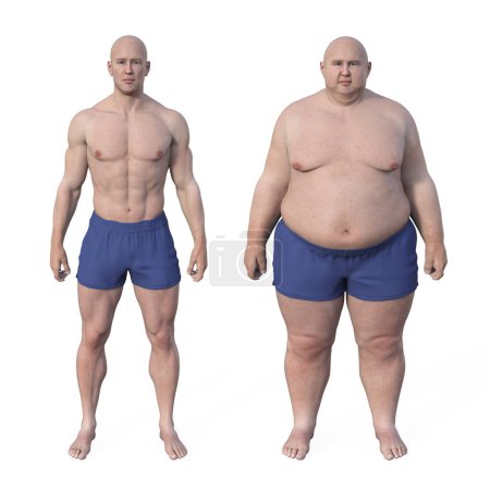 Eine vergleichende medizinische 3D-Illustration, die einen Mann mit normalem Gewicht und denselben Mann mit Übergewicht zeigt und die anatomischen und physiologischen Unterschiede hervorhebt.
