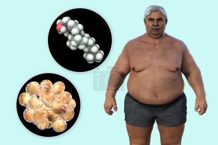 Téléchargez les photos : Illustration médicale 3D montrant un homme âgé en surpoids avec une vue rapprochée des adipocytes et des molécules de cholestérol, mettant en évidence la relation entre l'obésité et le métabolisme du cholestérol. - en image libre de droit