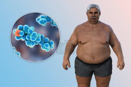 Photo for A 3D medical illustration featuring a senior overweight man with a close-up view of a cholesterol molecule, highlighting the connection between obesity and alterations in cholesterol metabolism. - Royalty Free Image