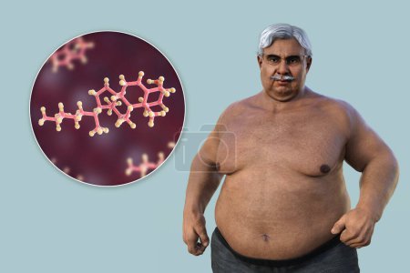Foto de Una ilustración médica en 3D que presenta a un hombre mayor con sobrepeso con una vista cercana de una molécula de colesterol, destacando la conexión entre la obesidad y las alteraciones en el metabolismo del colesterol.. - Imagen libre de derechos