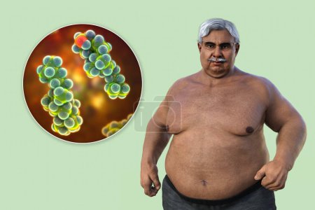 Photo for A 3D medical illustration featuring a senior overweight man with a close-up view of a cholesterol molecule, highlighting the connection between obesity and alterations in cholesterol metabolism. - Royalty Free Image