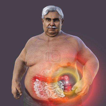 Photo for A senior overweight man with transparent skin, showcasing the digestive system, and highlighting the presence of large intestine spasms associated with irritable bowel syndrome, 3D illustration - Royalty Free Image