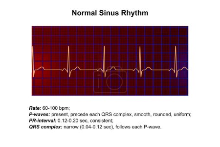 Foto de Un electrocardiograma ECG normal, ilustración 3D que muestra la actividad eléctrica del corazón en un individuo sano. - Imagen libre de derechos
