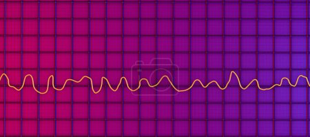 Téléchargez les photos : Illustration scientifique 3D représentant un électrocardiogramme ECG montrant le rythme chaotique de la fibrillation ventriculaire, une arythmie cardiaque potentiellement mortelle. - en image libre de droit