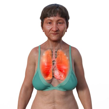 Téléchargez les photos : Illustration photoréaliste 3D de la moitié supérieure d'une patiente à la peau transparente, présentant une paire de poumons sains dans des détails complexes. - en image libre de droit