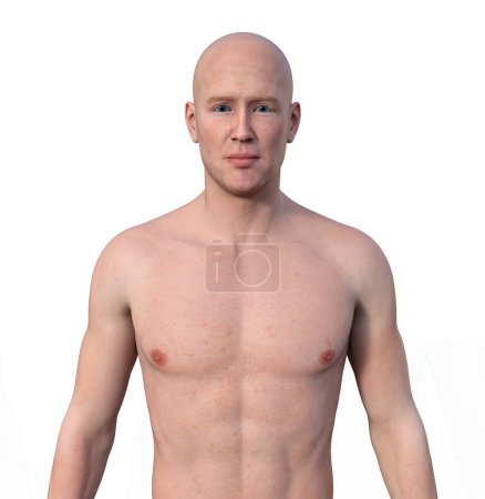 Foto de Una ilustración fotorrealista en 3D que muestra la mitad superior de un hombre desprovisto de pelo, mirando con confianza a la cámara, revelando su piel, rasgos faciales y anatomía corporal - Imagen libre de derechos