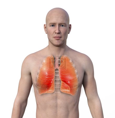 Foto de Una ilustración fotorrealista 3D de la mitad superior de un hombre con piel transparente, mostrando un par de pulmones sanos en intrincados detalles. - Imagen libre de derechos