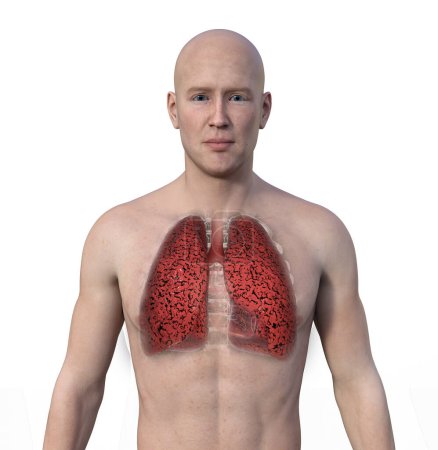 Téléchargez les photos : Illustration photoréaliste 3D de la moitié supérieure d'un homme à la peau transparente, révélant l'état des poumons du fumeur. - en image libre de droit