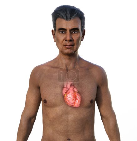 Photo for A 3D photorealistic illustration of the upper half part of a senior man with transparent skin, revealing detailed anatomy of the heart - Royalty Free Image