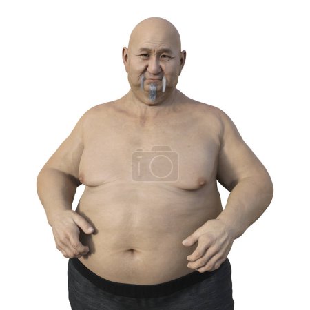 Téléchargez les photos : Illustration scientifique 3D d'un homme asiatique âgé et en surpoids, mettant en évidence la partie supérieure de son corps et soulignant les implications de l'obésité sur la santé. - en image libre de droit
