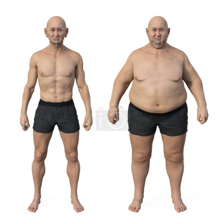 Foto de Una ilustración médica comparativa en 3D que representa a un hombre de peso normal y al mismo hombre con sobrepeso, destacando las diferencias anatómicas y fisiológicas. - Imagen libre de derechos