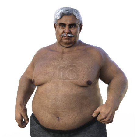Téléchargez les photos : Un homme avec une composition corporelle en surpoids, illustration médicale 3D soulignant les implications physiologiques de l'excès de poids - en image libre de droit