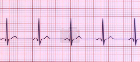 Foto de Un electrocardiograma ECG normal, ilustración 3D que muestra la actividad eléctrica del corazón en un individuo sano. - Imagen libre de derechos