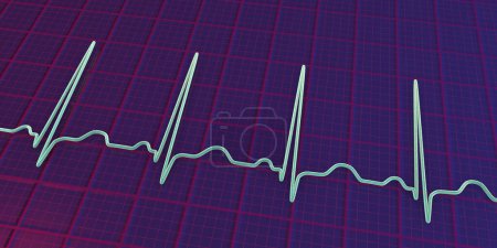 Photo for A detailed 3D illustration of an Electrocardiogram ECG displaying sinus tachycardia, a regular cardiac rhythm with heart rate that is higher than the upper limit of normal of 90-100 bpm in adults. - Royalty Free Image