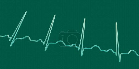 Téléchargez les photos : Illustration 3D détaillée d'un électrocardiogramme ECG montrant une tachycardie sinusale, un rythme cardiaque régulier avec une fréquence cardiaque supérieure à la limite supérieure de la normale de 90 à 100 bpm chez l'adulte. - en image libre de droit
