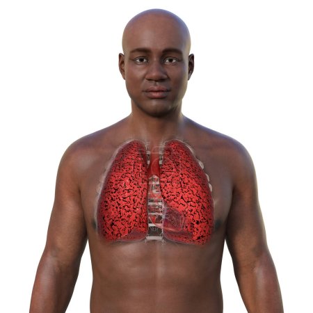 Téléchargez les photos : Illustration 3D photoréaliste de la moitié supérieure d'un Africain à la peau transparente, révélant l'état des poumons du fumeur - en image libre de droit
