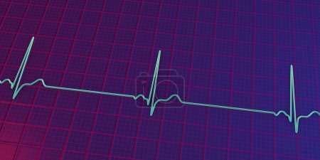 Foto de Una ilustración 3D detallada de un electrocardiograma que muestra bradicardia sinusal, una condición caracterizada por una frecuencia cardíaca lenta que se origina en el nodo sinusal, típicamente por debajo de 60 latidos por minuto.. - Imagen libre de derechos
