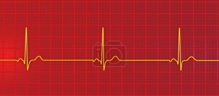 Téléchargez les photos : Illustration 3D détaillée d'un électrocardiogramme montrant une bradycardie sinusale, une condition caractérisée par une fréquence cardiaque lente provenant du nœud sinusal, généralement inférieure à 60 battements par minute. - en image libre de droit