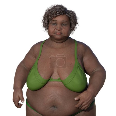 Téléchargez les photos : Une femme avec une composition corporelle en surpoids, illustration médicale 3D soulignant les implications physiologiques de l'excès de poids. - en image libre de droit