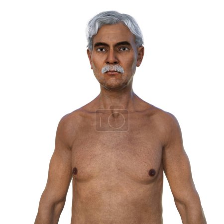 Téléchargez les photos : Illustration photoréaliste en 3D représentant la moitié supérieure d'un Indien âgé, mettant en valeur sa peau vieillissante, et les changements anatomiques qui viennent avec l'âge - en image libre de droit