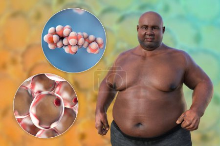 Téléchargez les photos : Illustration médicale 3D montrant un homme en surpoids avec une vue rapprochée des adipocytes et des molécules de cholestérol, mettant en évidence la relation entre l'obésité et le métabolisme du cholestérol. - en image libre de droit