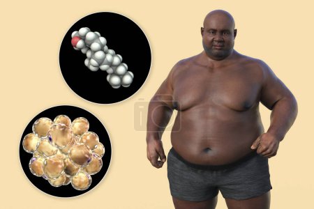 Foto de Una ilustración médica en 3D que presenta a un hombre con sobrepeso con una visión cercana de los adipocitos y las moléculas de colesterol, destacando la relación entre la obesidad y el metabolismo del colesterol. - Imagen libre de derechos