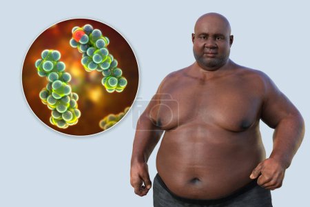 Foto de Una ilustración médica en 3D que presenta a un hombre con sobrepeso con una vista cercana de una molécula de colesterol, destacando la conexión entre la obesidad y las alteraciones en el metabolismo del colesterol. - Imagen libre de derechos