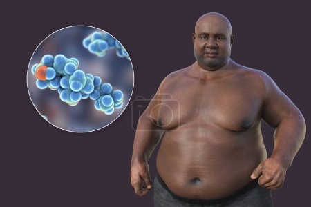 Foto de Una ilustración médica en 3D que presenta a un hombre con sobrepeso con una vista cercana de una molécula de colesterol, destacando la conexión entre la obesidad y las alteraciones en el metabolismo del colesterol. - Imagen libre de derechos