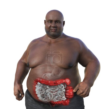 Photo for An overweight man with transparent skin, showcasing the digestive system, and highlighting the presence of large intestine spasms associated with irritable bowel syndrome, 3D illustration. - Royalty Free Image