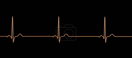 Foto de Una ilustración 3D detallada de un electrocardiograma que muestra bradicardia sinusal, una condición caracterizada por una frecuencia cardíaca lenta que se origina en el nodo sinusal, típicamente por debajo de 60 latidos por minuto.. - Imagen libre de derechos