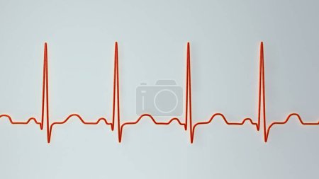 Téléchargez les photos : Illustration 3D détaillée d'un électrocardiogramme ECG montrant une tachycardie sinusale, un rythme cardiaque régulier avec une fréquence cardiaque supérieure à la limite supérieure de la normale de 90 à 100 bpm chez l'adulte. - en image libre de droit