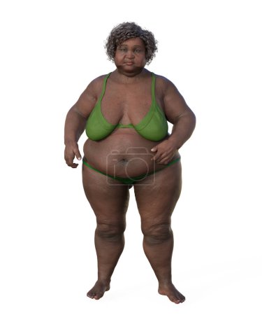 Foto de Una completa ilustración médica en 3D que retrata una representación de cuerpo entero de una mujer africana con sobrepeso composición corporal, destacando las implicaciones fisiológicas del exceso de peso. - Imagen libre de derechos