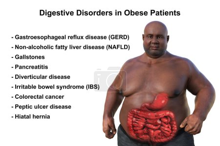 Photo for A detailed 3D medical illustration of an overweight man with transparent skin, revealing the digestive system and highlighting the digestive problems associated with obesity. - Royalty Free Image