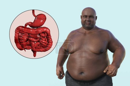 Photo for A detailed 3D medical illustration of an overweight man with transparent skin, revealing the digestive system and highlighting the digestive problems associated with obesity. - Royalty Free Image