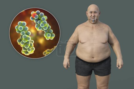 Photo for A 3D medical illustration featuring an overweight man with a close-up view of a cholesterol molecule, highlighting the connection between obesity and alterations in cholesterol metabolism. - Royalty Free Image