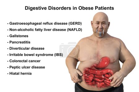 Foto de Una detallada ilustración médica en 3D de un hombre con sobrepeso y piel transparente, revelando el sistema digestivo y destacando los problemas digestivos asociados con la obesidad. - Imagen libre de derechos